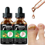 7 DAYS Nail Fungus Treatment Serum - Image 4