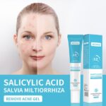 MOOYAM Salicylic Acid (Acne Removal Gel)