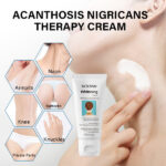 Whitening Cream for Acanthosis Nigricans Therapy - Image 6