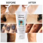 Whitening Cream for Acanthosis Nigricans Therapy - Image 4