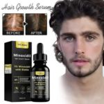 Minoxidil Hair Growth Serum - Image 3