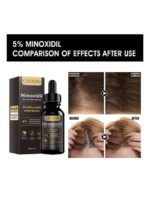 Canamin Minoxidil Hair Growth Serum - Image 5